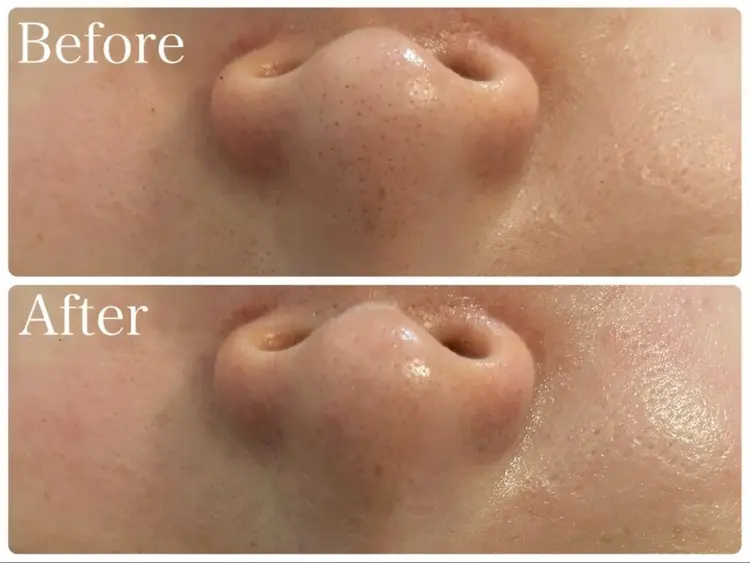 肌管理サロン Brillerの内観・外観2