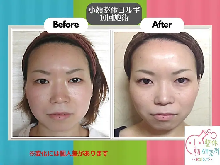 一度脱毛した眉毛はケア要らず◆次世代アイブロウ・眉毛脱毛研究所　MDラボ姫路店の内観・外観1