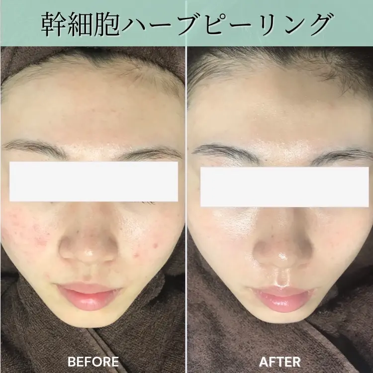 ヒト幹細胞サロン SkinBaby　新越谷店の内観・外観2