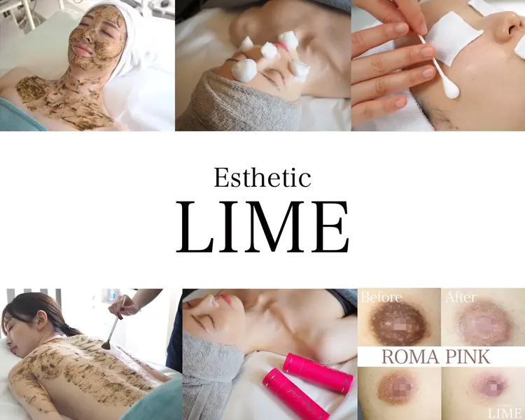 ハイフ専門店LIME池袋東口店の内観・外観1