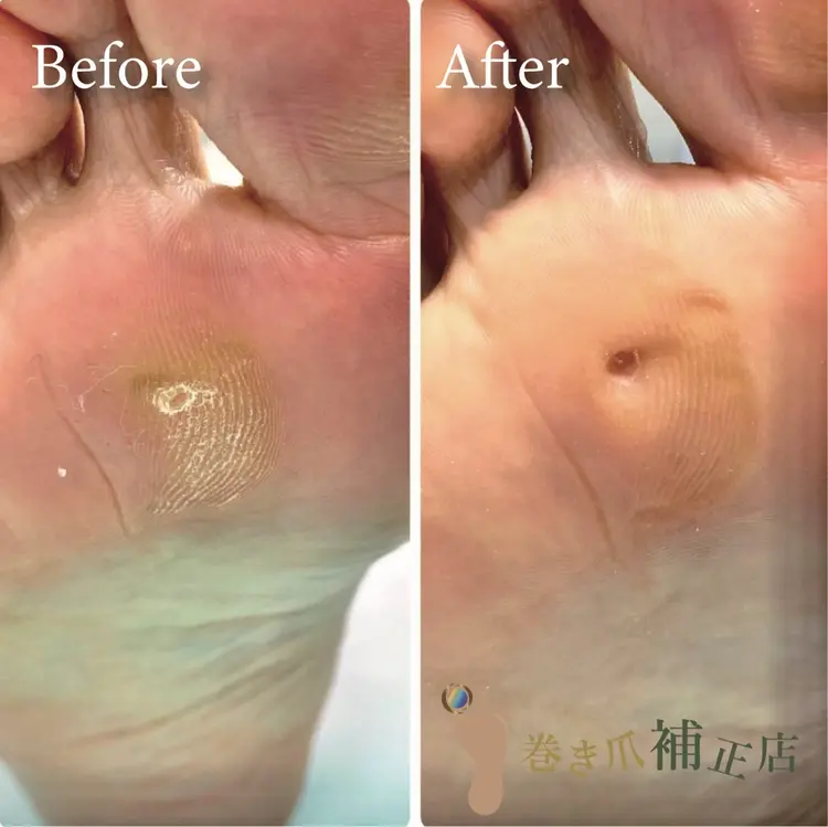 巻き爪補正店秋葉原店の内観・外観3