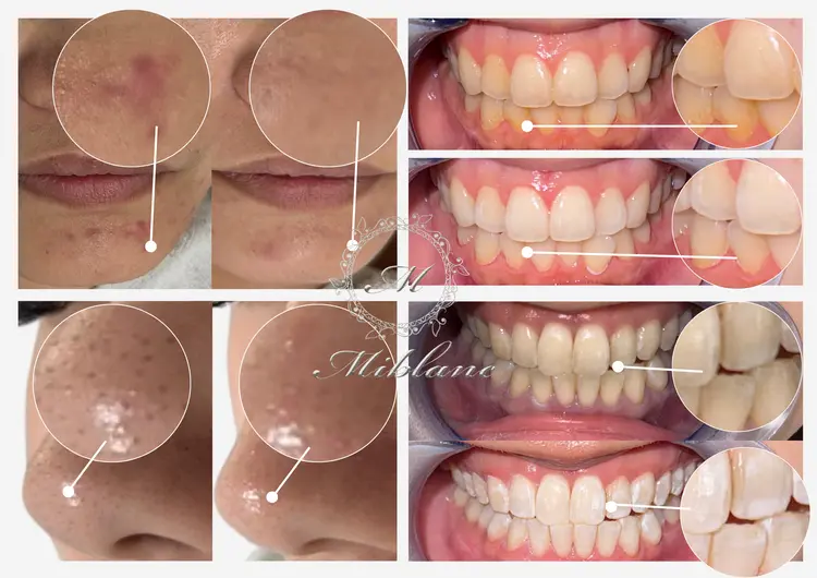 ホワイトニングサロンMIBLANCの内観・外観2