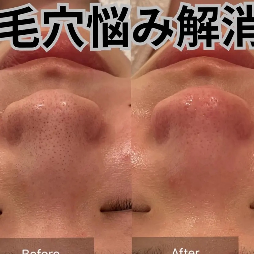 ルネアス スパの掲載