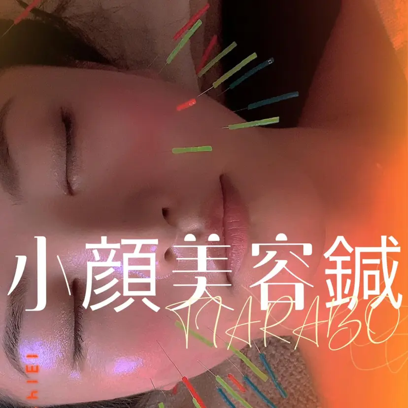 TIARABO 小顔美容鍼の掲載