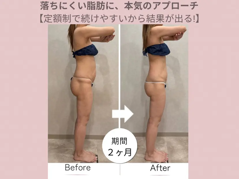 月額制痩身エステ FLORIAの掲載