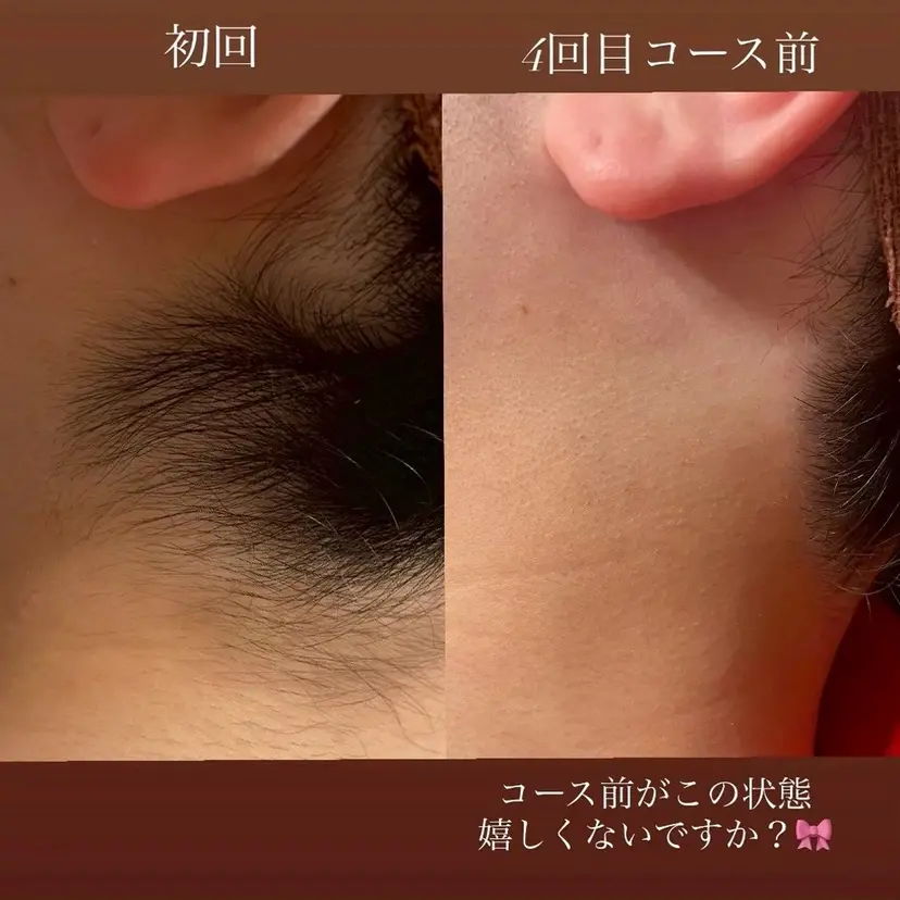 KA PILINAの掲載