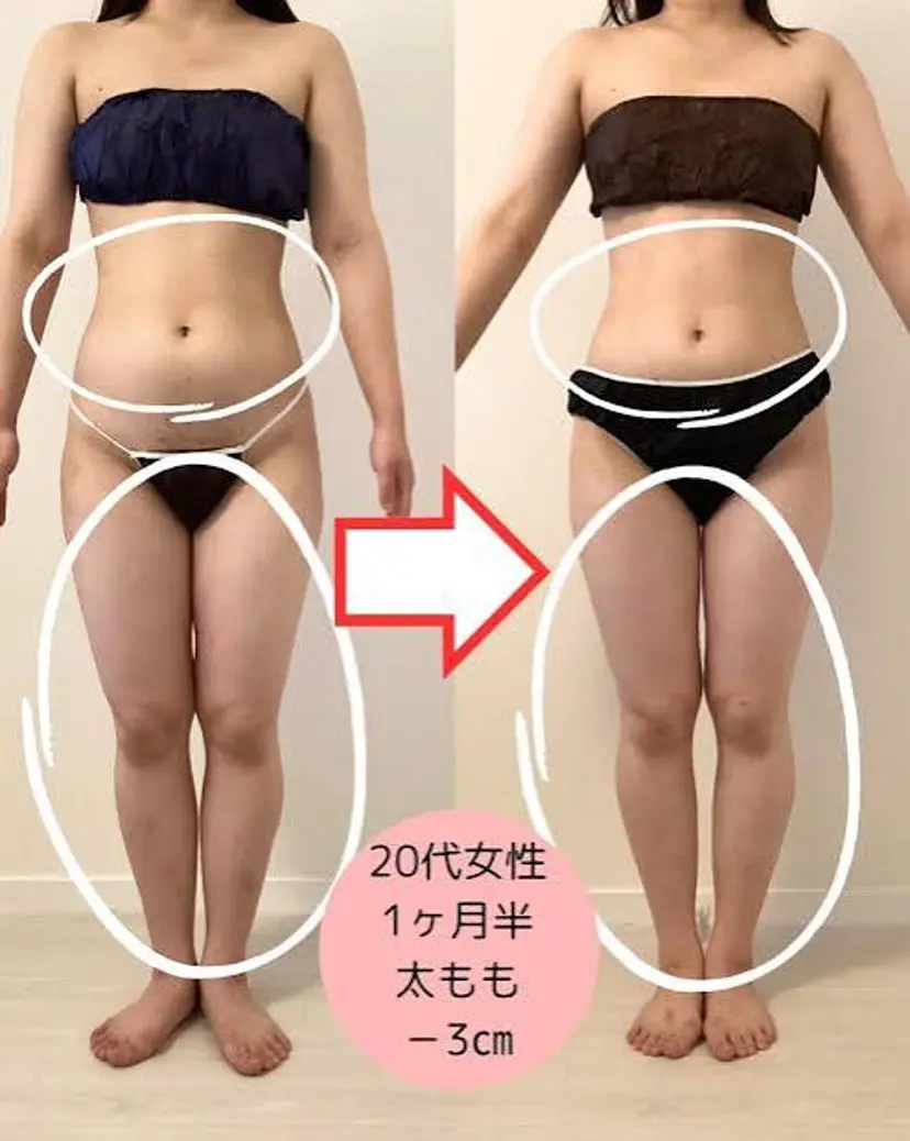 エステ 鈴木の掲載