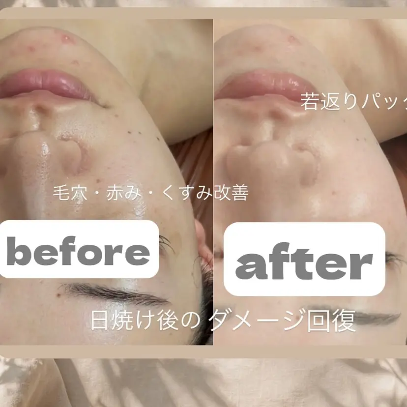 浮腫|肩こり|張り 日々の疲れを解消★の掲載