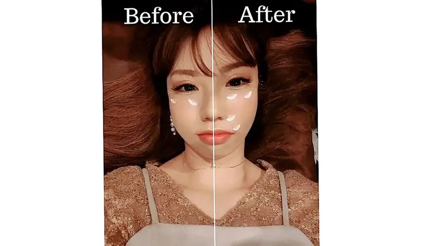 美容鍼灸サロン LOMIHARIの掲載