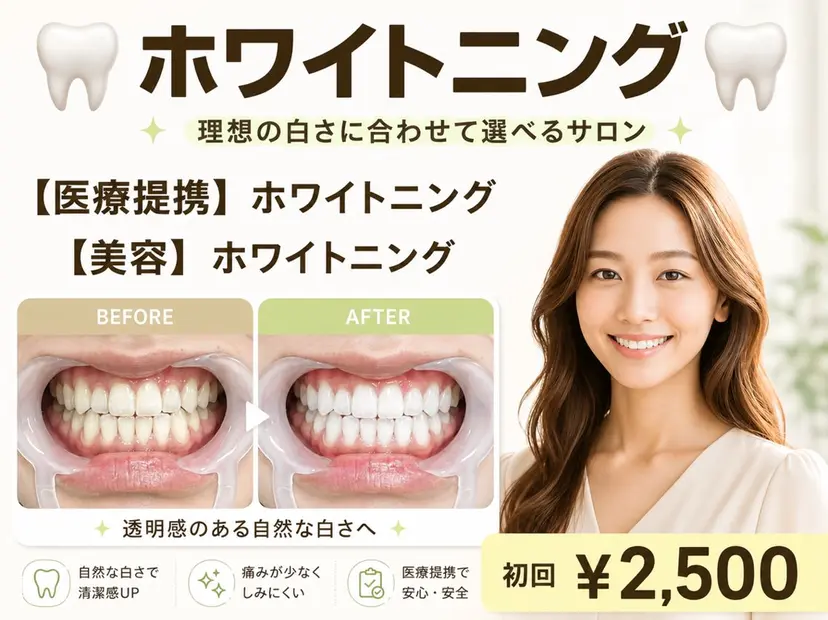 セルフホワイトニング 池袋　プラネットの掲載