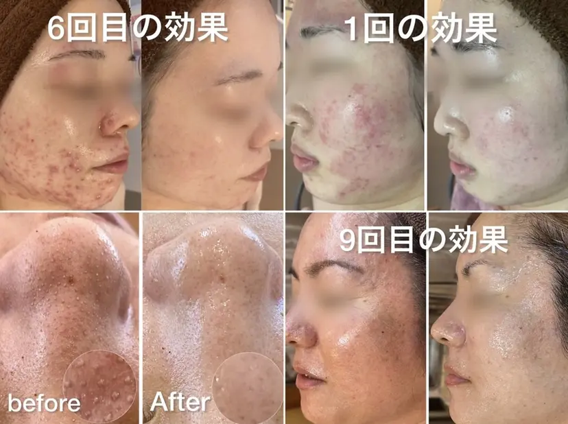 上地 怜那の掲載