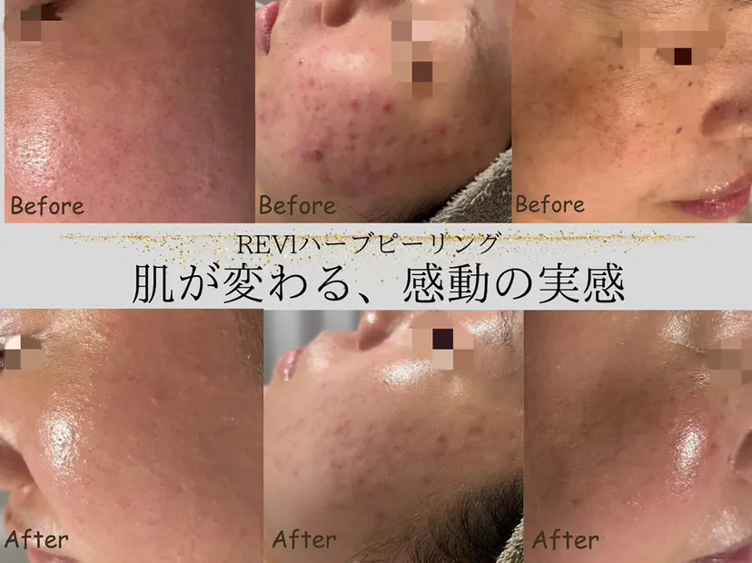 lumi riseの掲載