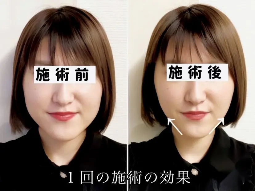 渋谷 小顔美容鍼 専門サロン YZの掲載