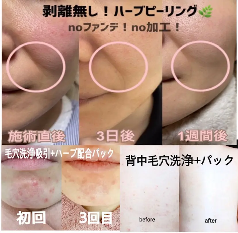 肌ケア&毛穴洗浄 Cheri/女性専用の掲載
