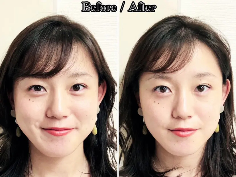 小顔美容鍼 渋谷 YZ 山崎の掲載