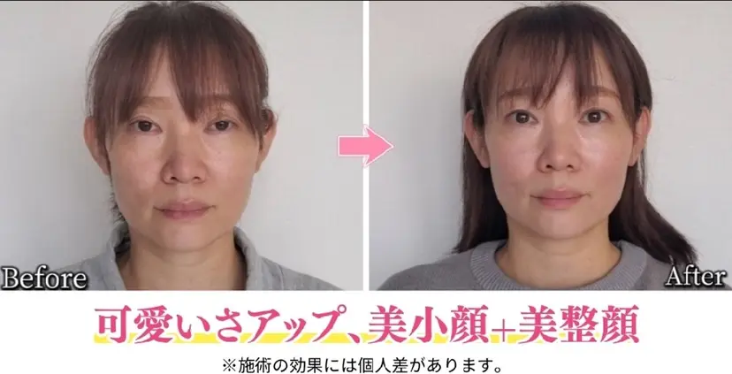 美容整体サロン DOLCE の掲載