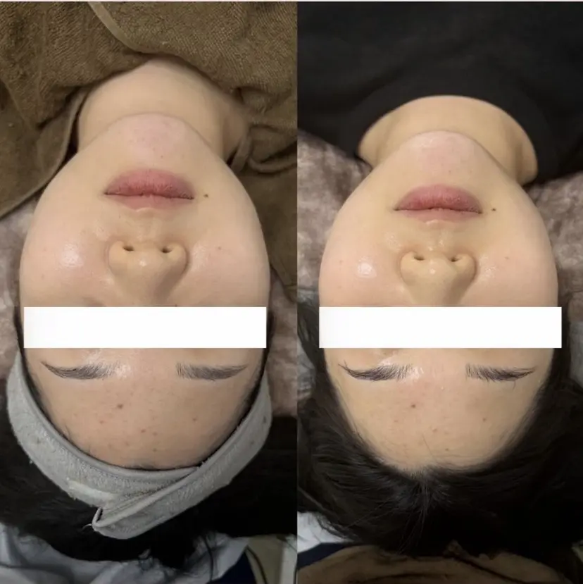 韓国式肌管理ナスサロ 看護師 Ayaの掲載