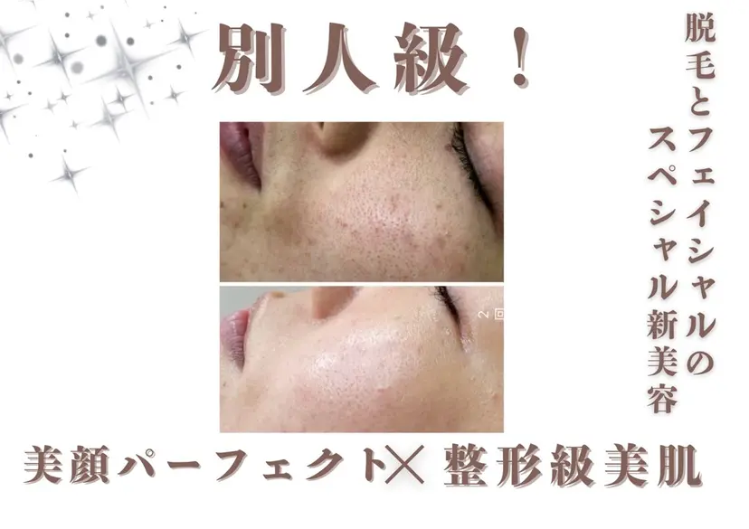 🫧エステティック RAYVIS池袋🐳の掲載