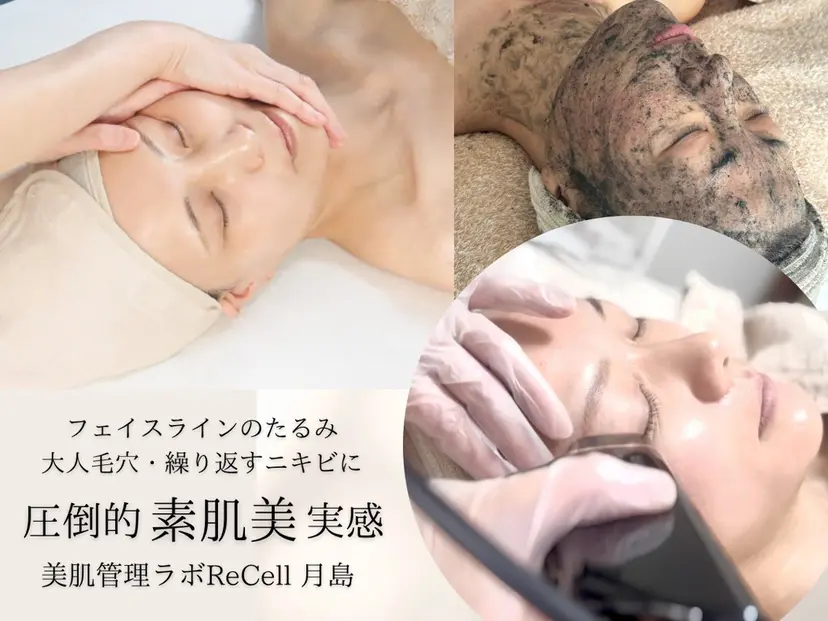 ReCell 肌管理の掲載