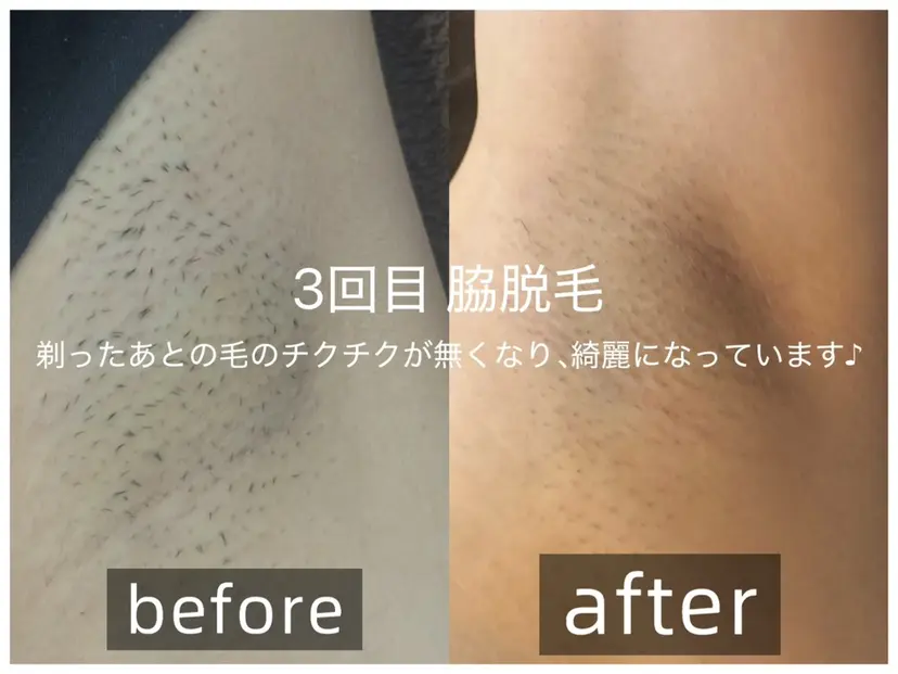 浮腫|肩こり|張り 日々の疲れを解消★の掲載