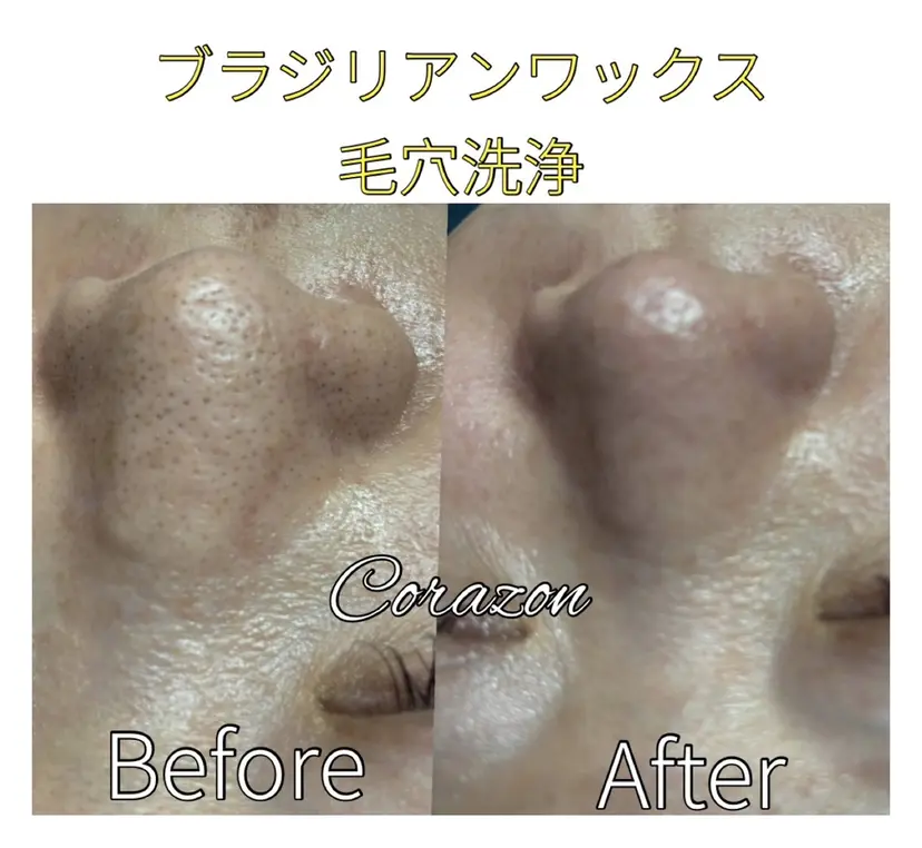 Corazon コラゾンの掲載
