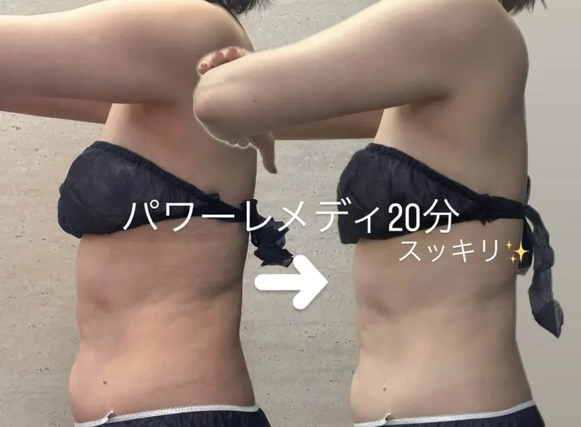 浮腫|肩こり|張り 日々の疲れを解消★の掲載