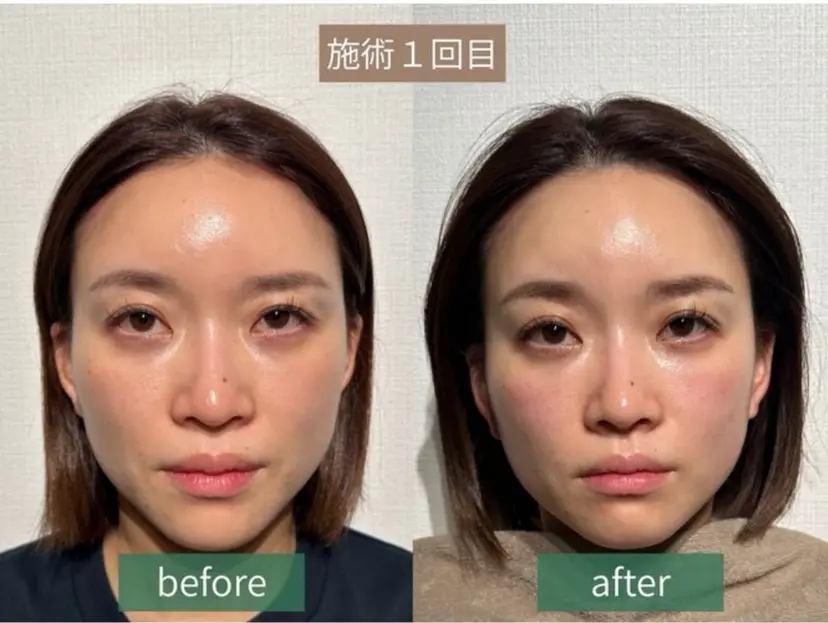 Ru miの掲載