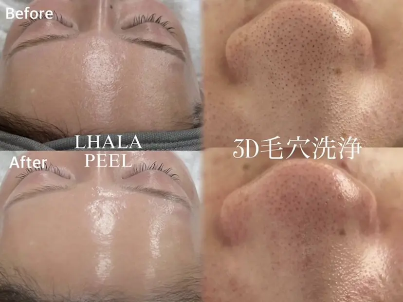 韓国美容専門 TIARA.烏丸三条の掲載