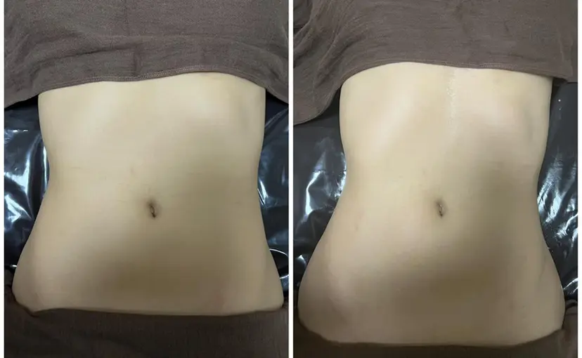 巻き肩・疲れ顔ケア Nemophilaの掲載