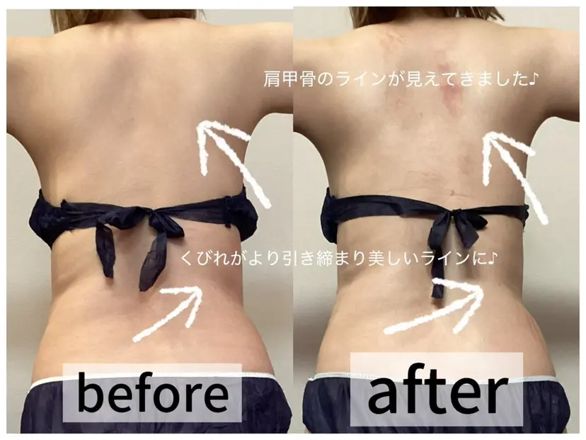 浮腫|肩こり|張り 日々の疲れを解消★の掲載