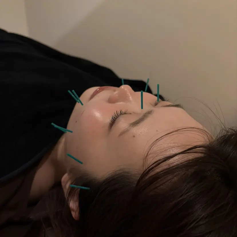 鍼灸師🌿 染谷彩和の掲載
