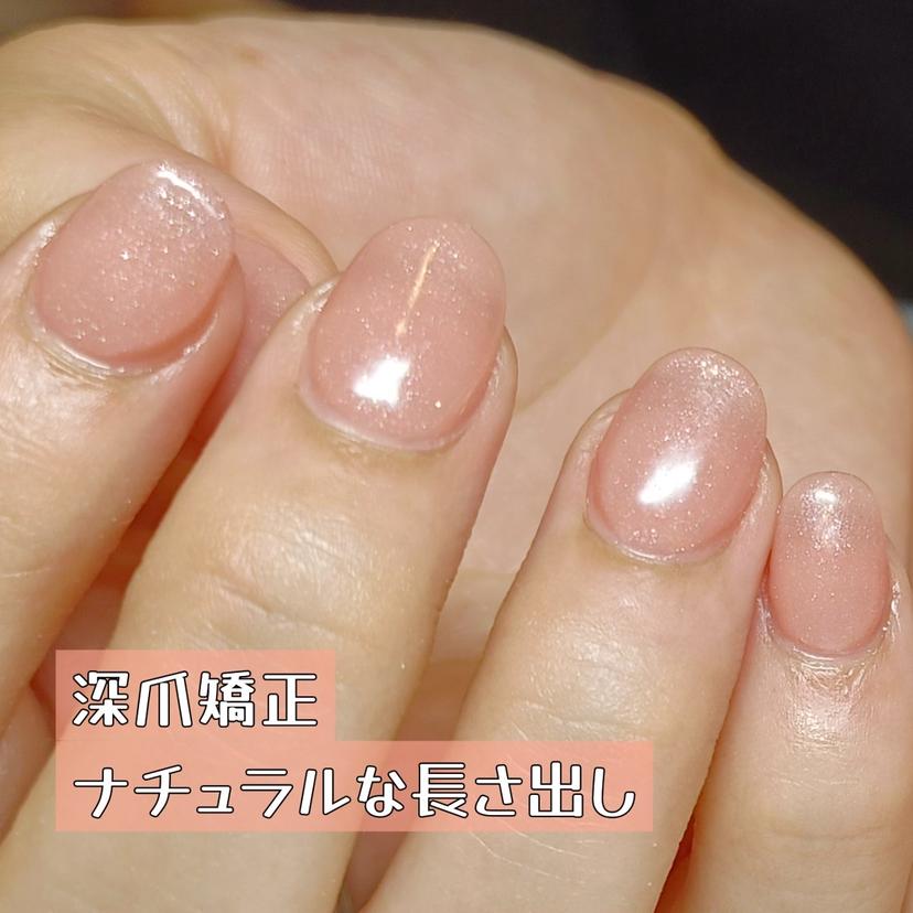 深爪矯正/爪育成ケア manie nailの掲載