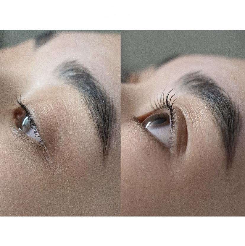 Öde eyeの掲載