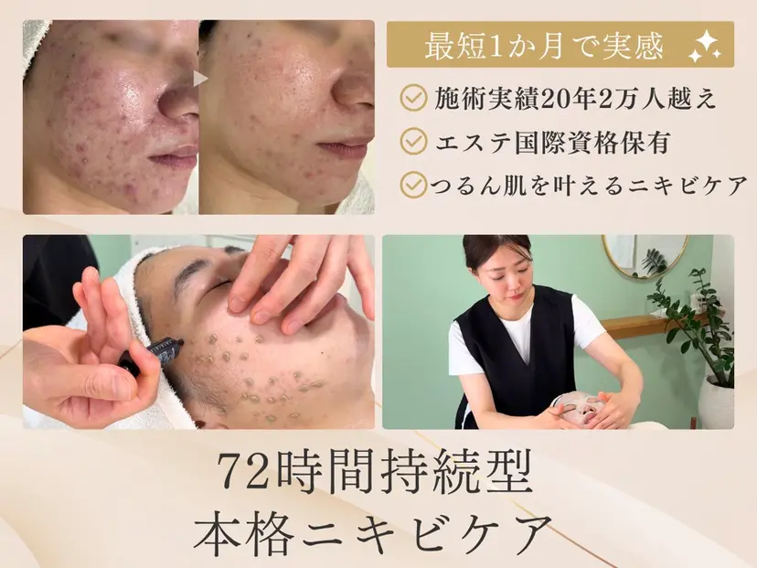 ニキビ・毛穴・ フェイシャル専門店の掲載
