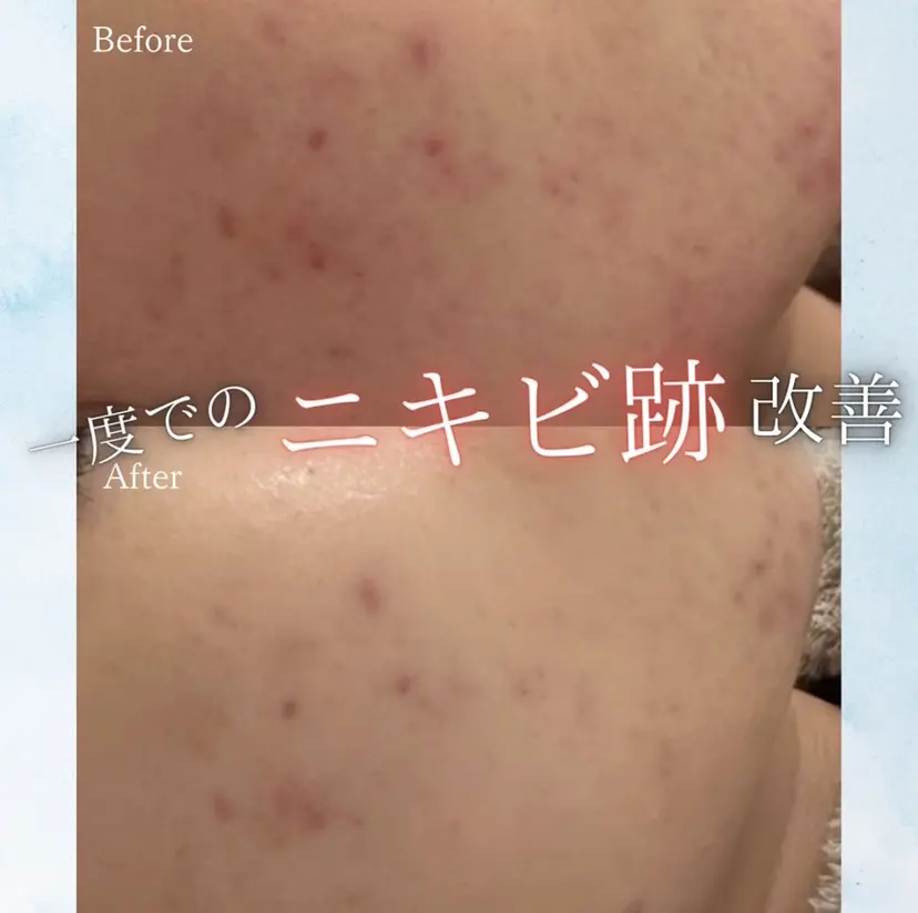 髙山 美優の掲載