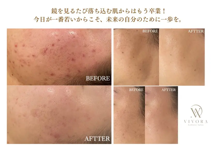 VIVORA ASAMI🌿の掲載
