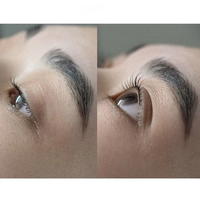 Öde eyeの掲載