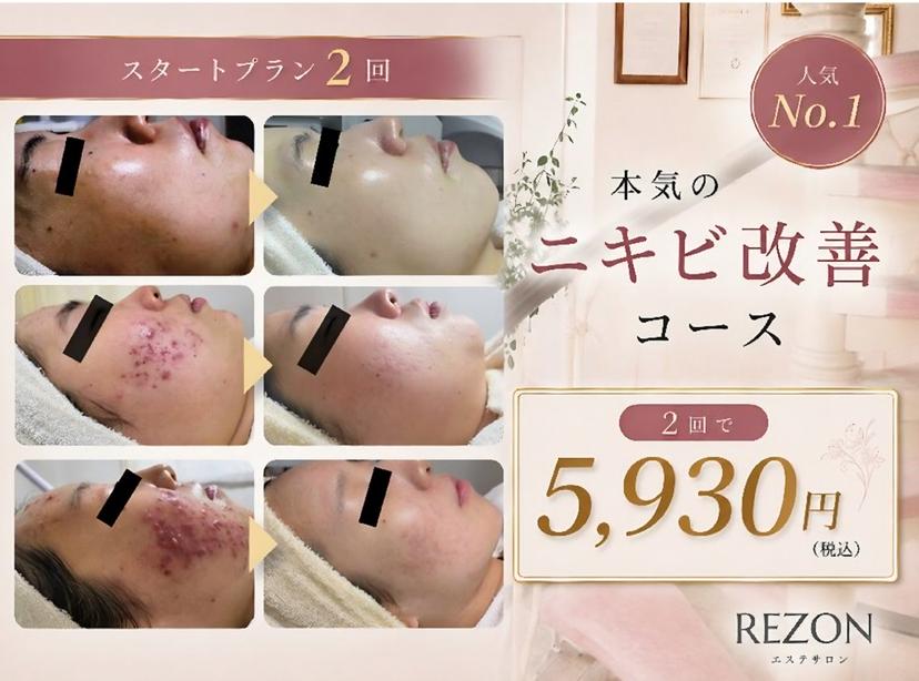 ニキビ・ニキビ跡専門 レゾン京橋店 の掲載