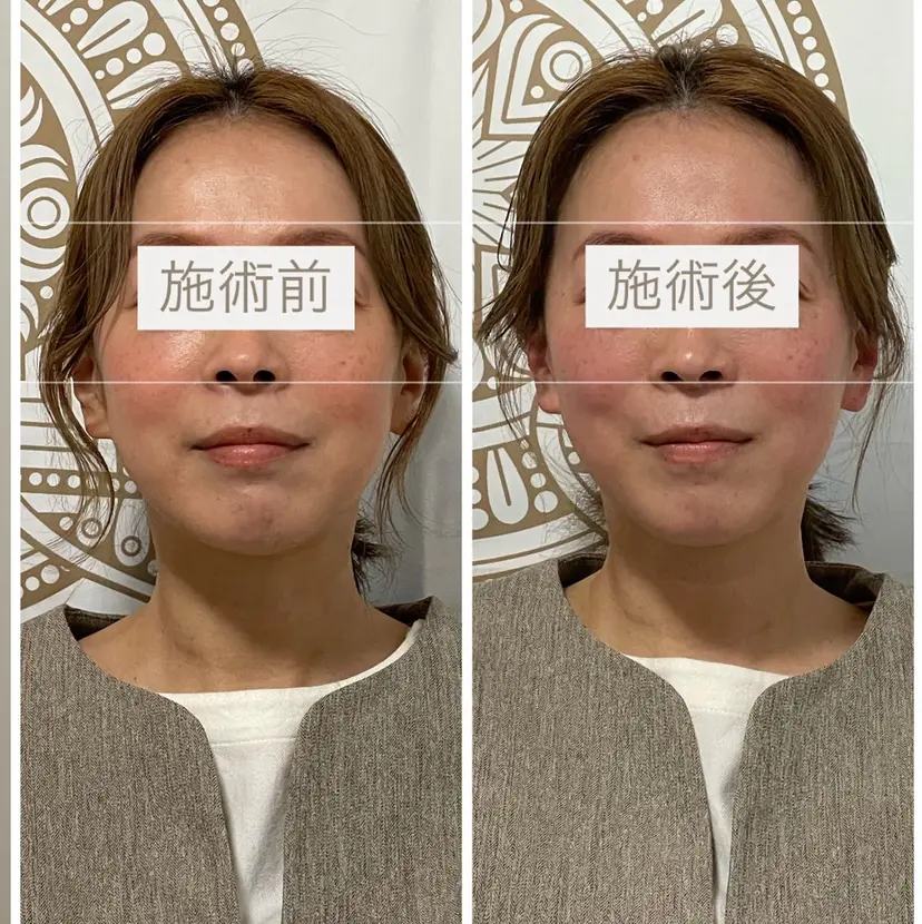 あだち整体エステ 首肩背中のゆるめぐの掲載