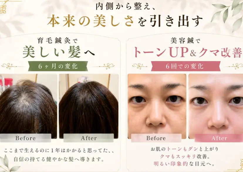 美容鍼灸師 齋藤 麗子の掲載