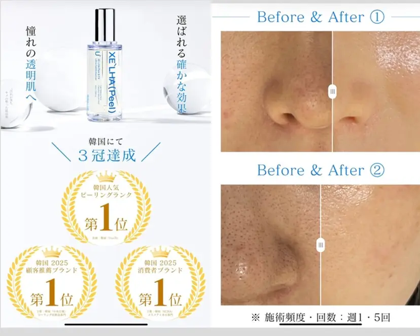 MO MOの掲載