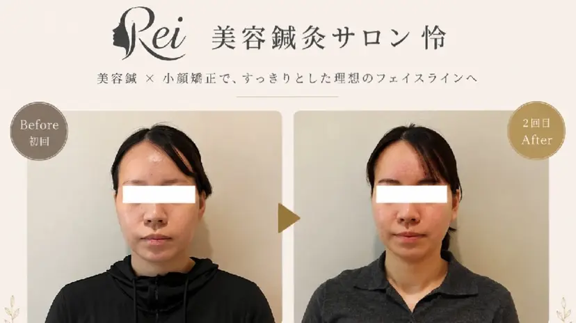 美容鍼灸サロン怜 -Rei-の掲載