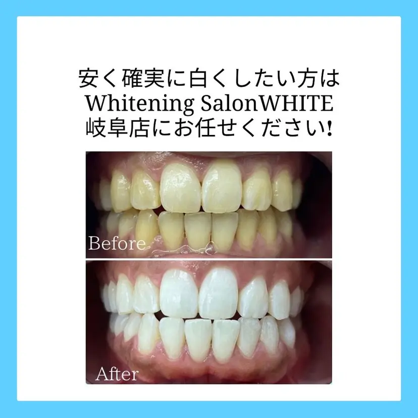 ホワイトニング専門店 WHITE岐阜店の掲載