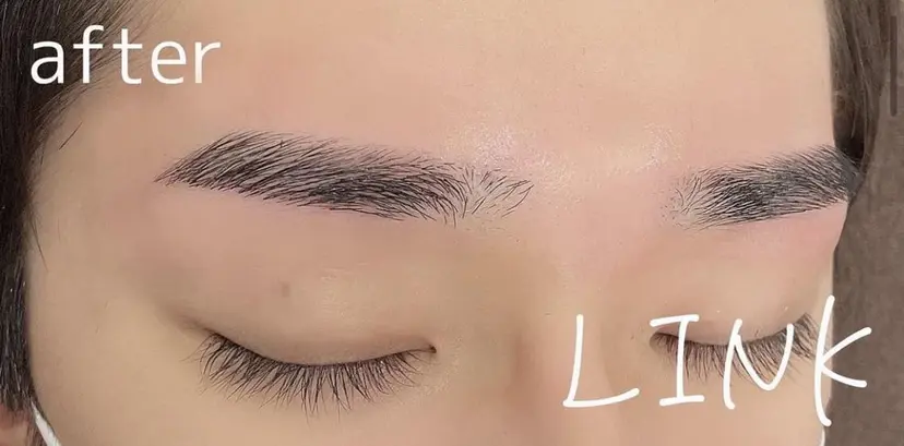 LI NKの掲載
