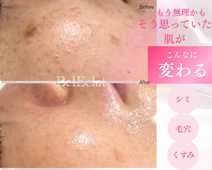 シミ・美肌専門サロン Bel Eclatの掲載
