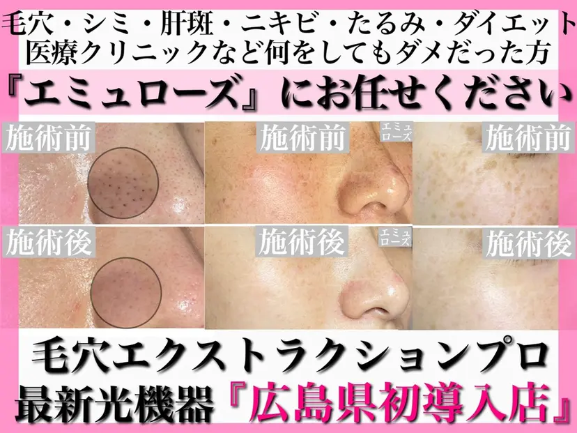 Nm'Rose .エミュローズの掲載