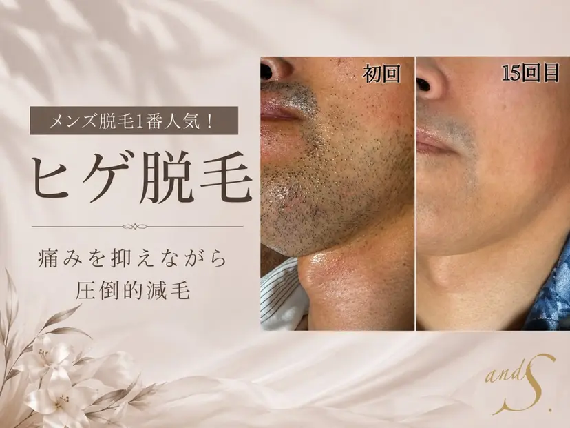 六本木脱毛andS 店長Sachiの掲載