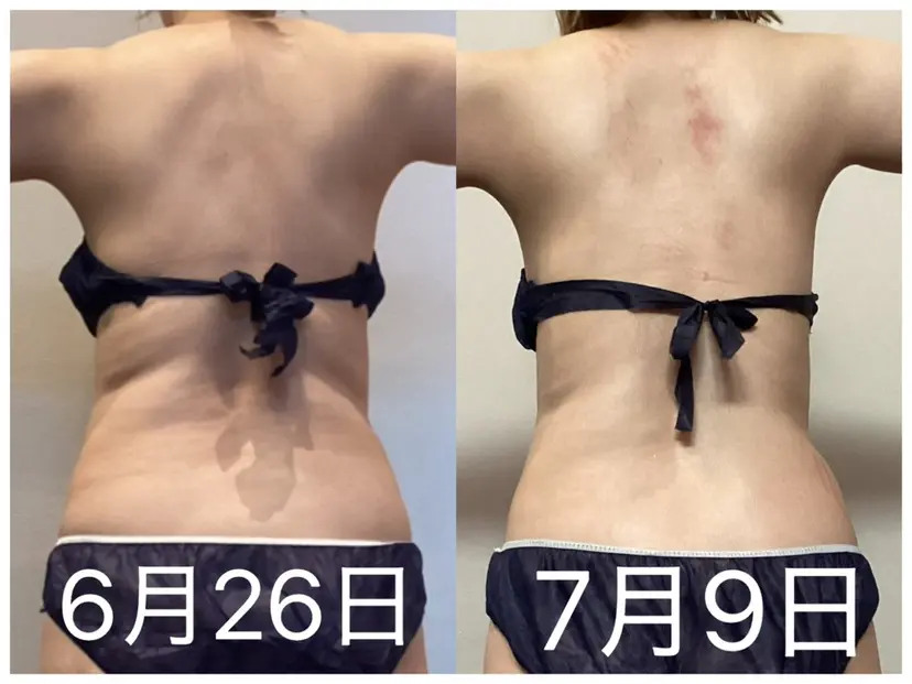 浮腫|肩こり|張り 日々の疲れを解消★の掲載