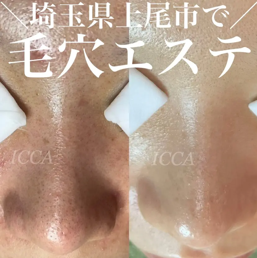 ICCA chikaの掲載