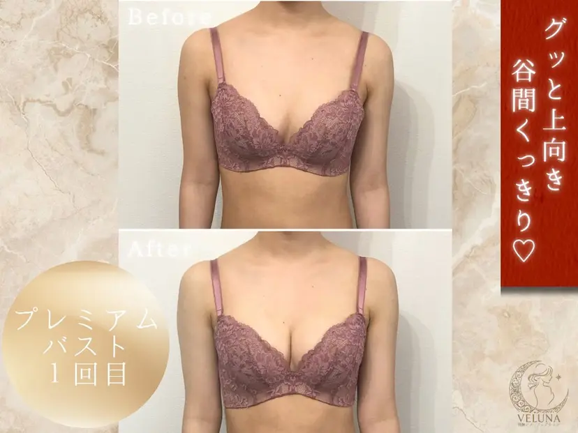 バスト専門サロン VELUNAの掲載